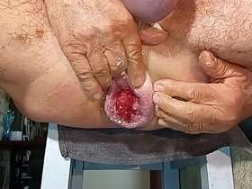 扩肛侠2025-14 japanese suit fantasy gay porn