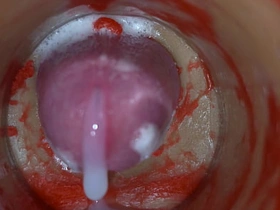 内射实录——体内镜头捕捉男性深喉射精 ginger plus chinese gay porn