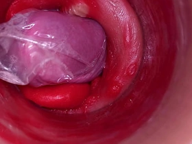 深入阴道的摄像头记录下带着套套的巨量射精 asian local gay sex videos